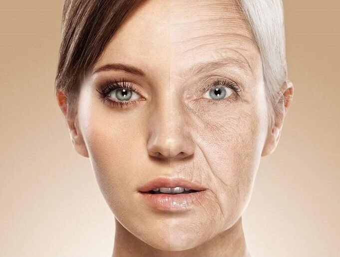 кожата на лицето преди и след лазерно подмладяване